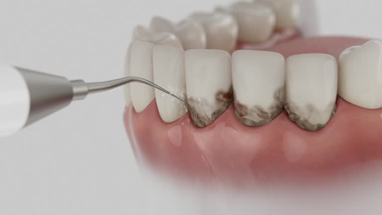Reliable Dental Implants contractor in Richmond, IL by Smile Center Dentistry